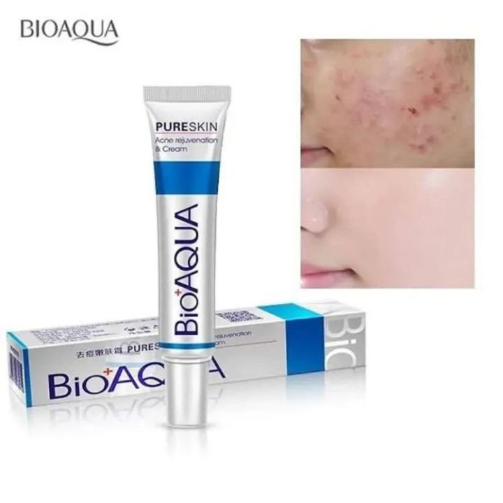 BioAqua Pure Skin ACNE Removal & Rejuvenation Cream – 30 gm